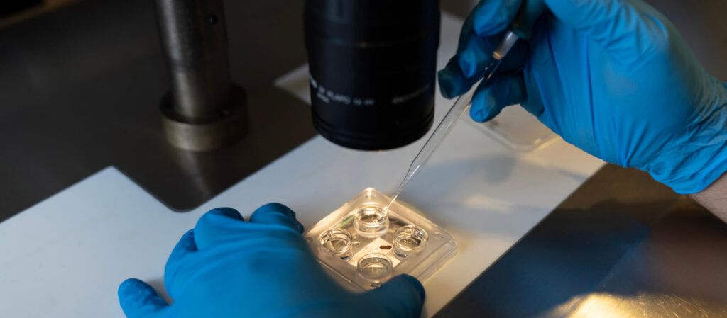 Embriologist collecting in vitro cultured embryos for biopsy.